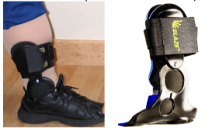 Custom-Made AFOs and Drop Foot Braces